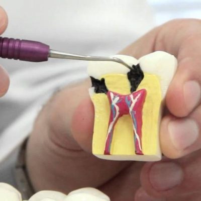 especializacao-em-endodontia especializacao-em-endodontia