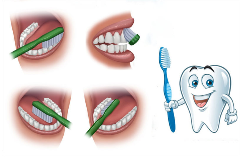 escovação adequada - vital impantes