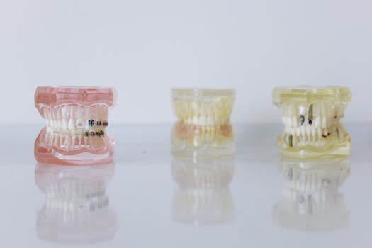 Dente Encavalado — Quais os Possíveis Tratamentos?