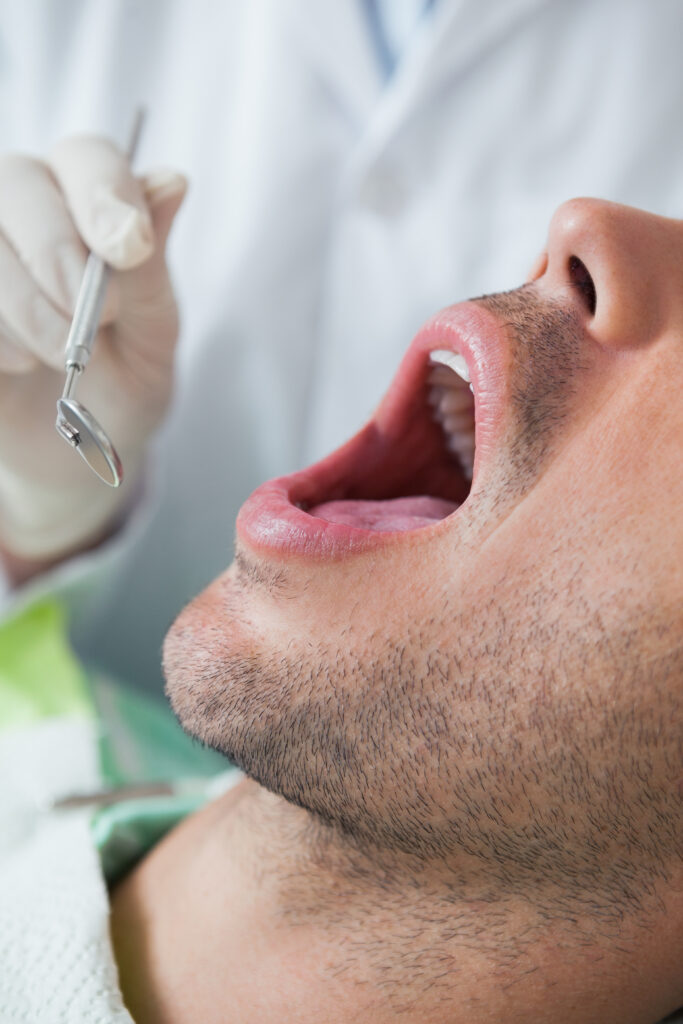 Afta na boca: o que é e como tratar e prevenir esse problema
