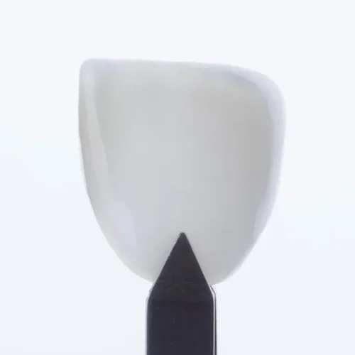 1772572413.laminados-ceramicos-estetica-dental-avancada-df_11zon