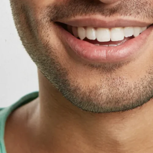 1772627127.reconstrução-dental-estetica-vital-implantes-df