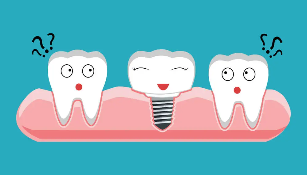 Voce Sabe Por Que Os Implantes Sao Feitos De Titanio
