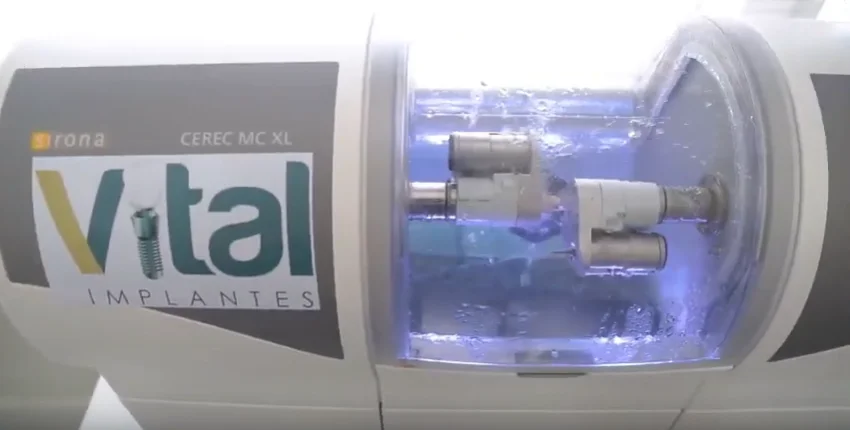 Entenda Como Funciona A Tecnologia De Impressao 3d E Sua Aplicacao Na Odontologia