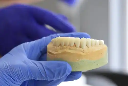 Implantes Dentarios Baratos Entenda Por Que Fugir Dessa Promessa